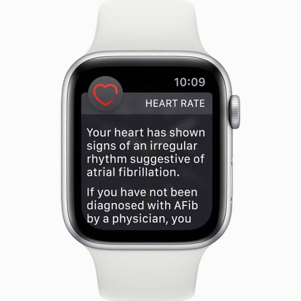 White Apple Watch with a heart rate alert on the screen. The text reads "Your heart rate has shown signs of an irregular rhythm suggestive of atrial fibrillation. If you have not been diagnosed with AFib by a physician, you..."