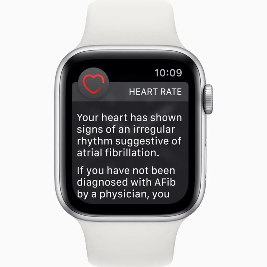 White Apple Watch with a heart rate alert on the screen. The text reads "Your heart rate has shown signs of an irregular rhythm suggestive of atrial fibrillation. If you have not been diagnosed with AFib by a physician, you..."